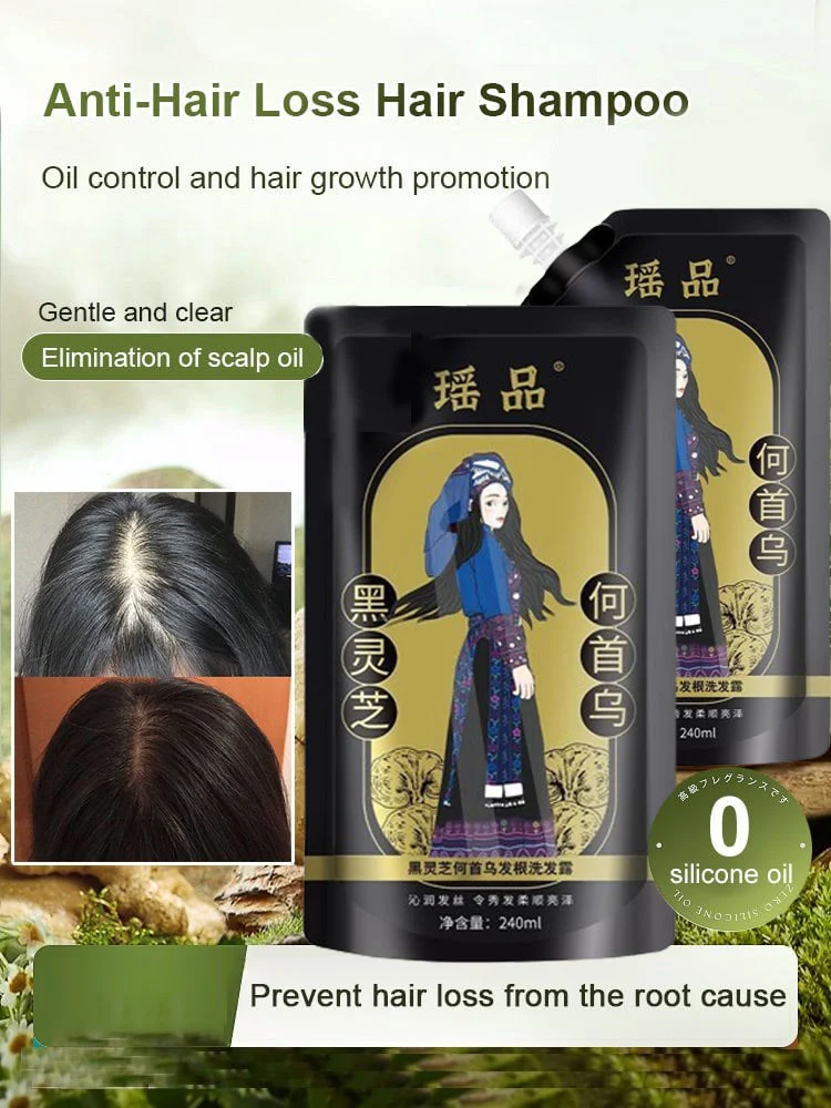 🔥New Year Sale 49% OFF🔥Hot Sale Ginger Plant Extract Anti-Hair Loss Hair Shampoo